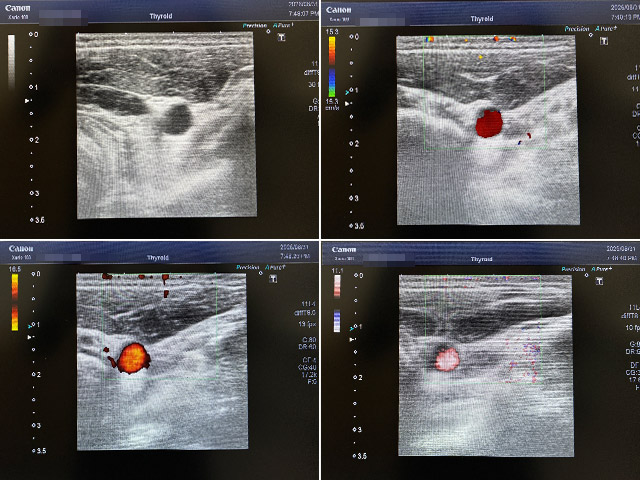 Ultrasound Xario100 TUS-X100 （Canon）No.0557195 - Used Medical Equipment ...