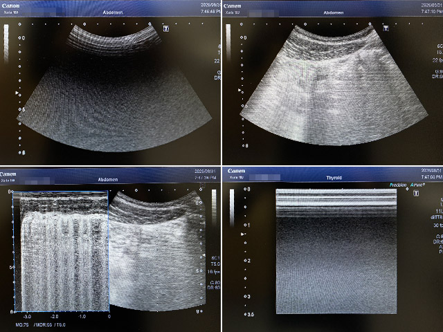 Ultrasound Xario100 TUS-X100 （Canon）No.0557195 - Used Medical Equipment ...